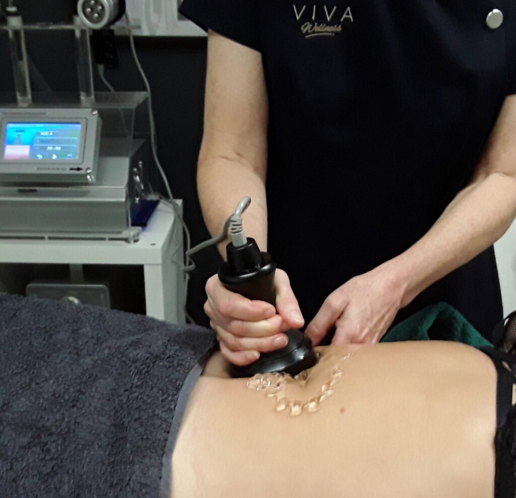 Fat Cavitation Treatment Brisbane