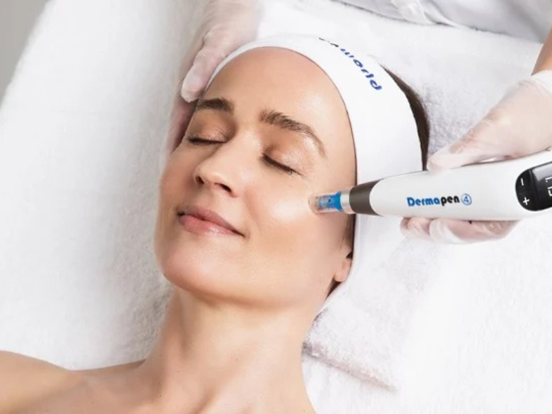 DermaPen MicroNeedling Non-invasive Anti-aging Treatment -
Facial Rejuvenation Without Injectables - Wrinkle treatments